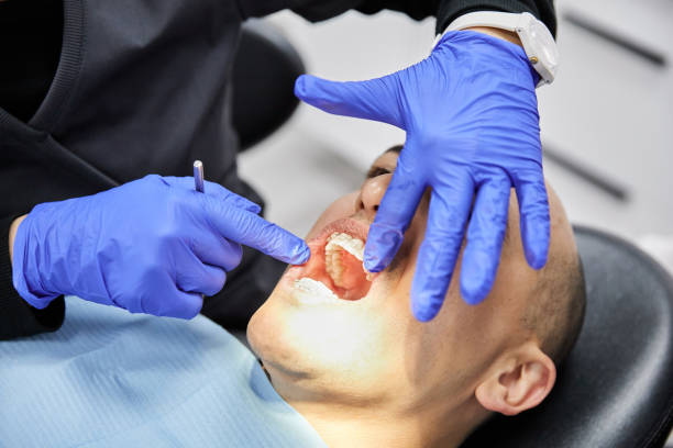 Best Emergency Treatment for Dental Infections or Abscesses in East Cleveland, OH