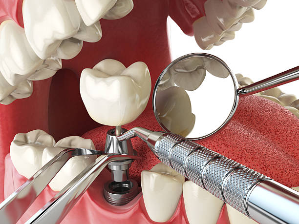 Best Emergency Denture Repair in East Cleveland, OH